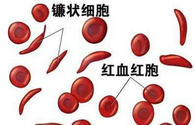 人體91看片免费版廠家介紹檢測微量元素的儀器 人體91看片免费版廠家介紹檢測微量元素的儀器
