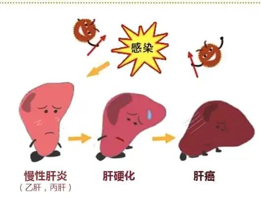 国产看片网站廠家提醒肝髒疾病治不好？要了解是否含鐵食物攝入多